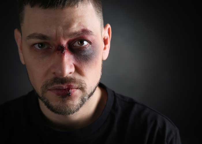 Black Eye, Assault & Battery charges